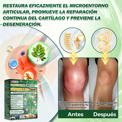 Tienda Oficial de EE. UU. 🇺🇸  | 🧑‍⚕️🩺 Curalona® Moringa · Berberina × NAD+ Parche nanomicron avanzado 10 en 1: resultados visibles en 2 días