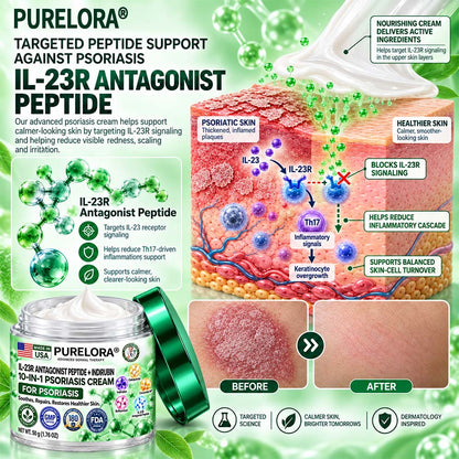 𝐎𝐟𝐟𝐢𝐜𝐢𝐚𝐥 𝐒𝐭𝐨𝐫𝐞 |💧💧 Purelora®𝑰𝑳-𝟐𝟑𝑹 𝑨𝒏𝒕𝒂𝒈𝒐𝒏𝒊𝒔𝒕 𝑷𝒆𝒑𝒕𝒊𝒅𝒆 + 𝑰𝒏𝒅𝒊𝒓𝒖𝒃𝒊𝒏 𝟏𝟎-𝑰𝑵-𝟏 𝑷𝒔𝒐𝒓𝒊𝒂𝒔𝒊𝒔 𝑪𝒓𝒆𝒂𝒎 （𝑯𝒆𝒍𝒑𝒔 𝑹𝒆𝒅𝒖𝒄𝒆 𝑽𝒊𝒔𝒊𝒃𝒍𝒆 𝑹𝒆𝒅𝒏𝒆𝒔𝒔 & 𝑺𝒄𝒂𝒍𝒊𝒏𝒈, 𝑺𝒐𝒐𝒕𝒉𝒆 𝑫𝒓𝒚𝒏𝒆𝒔𝒔 & 𝑰𝒕𝒄𝒉𝒊𝒏𝒈, 𝑺𝒖𝒑𝒑𝒐𝒓𝒕 𝑩𝒂𝒍𝒂𝒏𝒄𝒆𝒅 𝑺𝒌𝒊𝒏-𝑪𝒆𝒍𝒍 𝑹𝒆𝒏𝒆𝒘𝒂𝒍 & 𝑯𝒆𝒍𝒑 𝑹𝒆𝒊𝒏𝒇𝒐𝒓𝒄𝒆 𝒕𝒉𝒆 𝑺𝒌𝒊𝒏 𝑩𝒂𝒓𝒓𝒊𝒆𝒓）