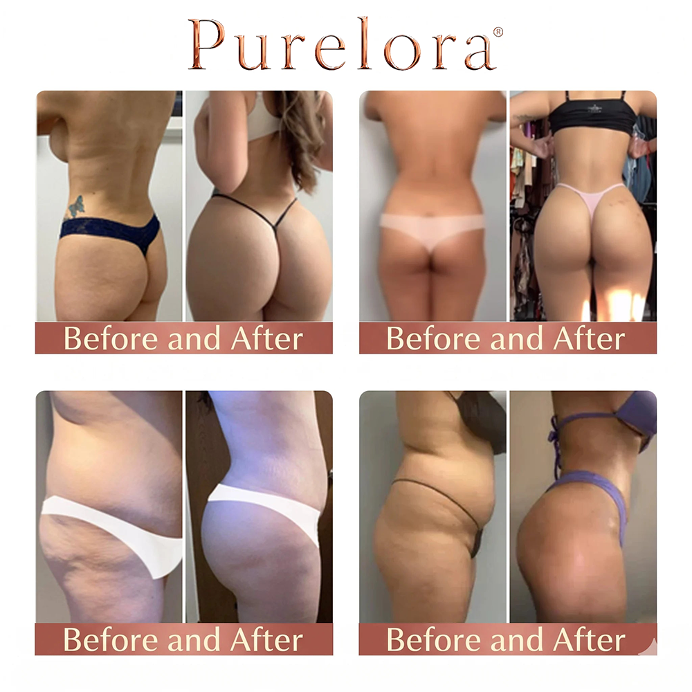 💕Purelora® CurveSculpt Micro-Patch ✦ Modela, reafirma y alisa las curvas de la parte inferior del cuerpo ✦ Sistema de infusión con microagujas