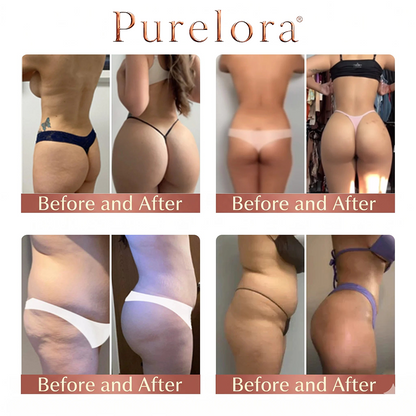💕Purelora® CurveSculpt Micro-Patch ✦ Modela, reafirma y alisa las curvas de la parte inferior del cuerpo ✦ Sistema de infusión con microagujas