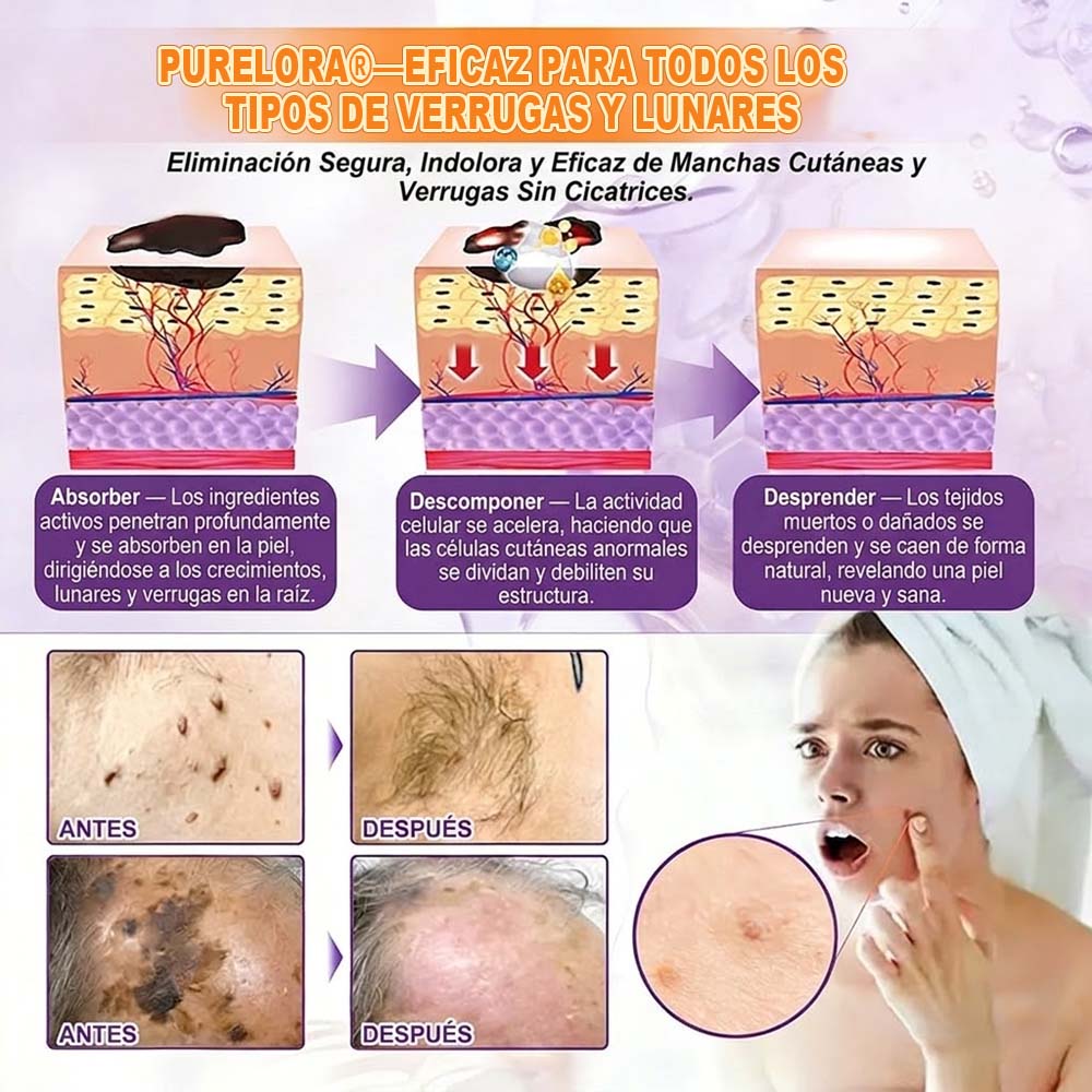 Fabricada y enviada desde EE. UU. 🍁 Crema reparadora de la piel Purelora® con biotina (fórmula 10 en 1) — Último día de oferta: 75 % de descuento.