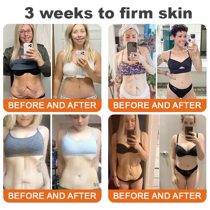 "Made and Shipped from America|✅ Official Store✨Purelora® Bee Venom Skin Restorative Cream 🔥 LAST DAY 80% OFF 💎"