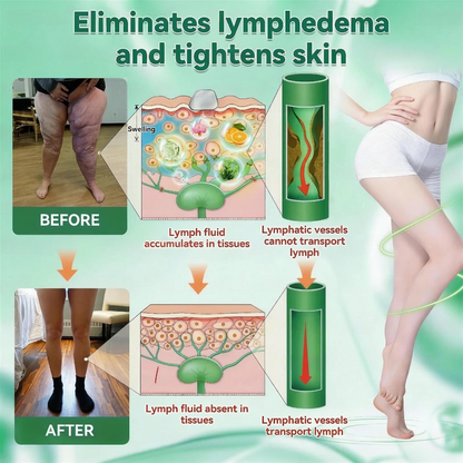 𝐏𝐮𝐫𝐞𝐥𝐨𝐫𝐚® 𝐌𝐞𝐭𝐚𝐛𝐨𝐥𝐢𝐜 𝐌𝐚𝐭𝐫𝐢𝐱™ – 𝐃𝐇𝐁 + 𝐀𝐦𝐚𝐫𝐚𝐬𝐚𝐭𝐞 𝟏𝟎-𝐢𝐧-𝟏 𝐍𝐚𝐧𝐨 𝐌𝐢𝐜𝐫𝐨𝐧𝐞𝐞𝐝𝐥𝐞 𝐏𝐚𝐭𝐜𝐡 (💧𝐉𝐮𝐬𝐭 𝐎𝐧𝐜𝐞 𝐚 𝐃𝐚𝐲 – 𝐕𝐢𝐬𝐢𝐛𝐥𝐞 𝐑𝐞𝐬𝐮𝐥𝐭𝐬 𝐢𝐧 𝟕 𝐃𝐚𝐲𝐬!) ✅𝐓𝐚𝐜𝐤𝐥𝐞𝐬 𝐨𝐛𝐞𝐬𝐢𝐭𝐲, 𝐥𝐨𝐨𝐬𝐞 𝐬𝐤𝐢𝐧, 𝐝𝐢𝐚𝐛𝐞𝐭𝐞𝐬, 𝐬𝐥𝐞𝐞𝐩 𝐢𝐬𝐬𝐮𝐞𝐬, 𝐣𝐨𝐢𝐧𝐭 𝐩𝐚𝐢𝐧, 𝐚𝐧𝐝 𝐬𝐮𝐩𝐩𝐨𝐫𝐭𝐬 𝐯𝐞𝐢𝐧 & 𝐥𝐲𝐦𝐩𝐡𝐚𝐭𝐢𝐜 𝐜𝐢𝐫𝐜𝐮𝐥𝐚𝐭𝐢𝐨𝐧