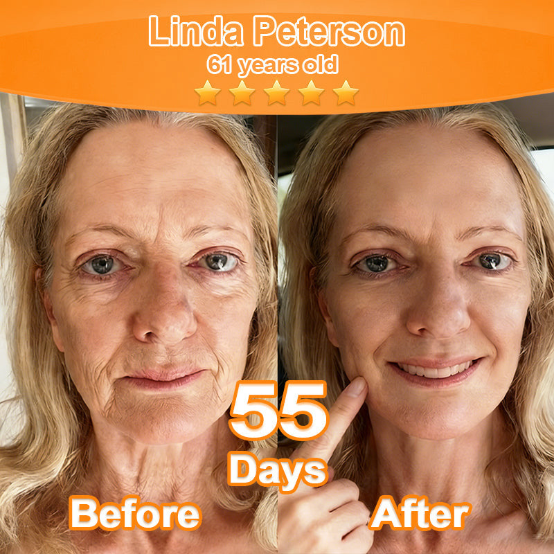 Purelora® Stem Cell Extract EGF and Copper Peptide Revitalizing Essence Cream (deeply activates the skin's internal regeneration, making the skin firmer and smoother)