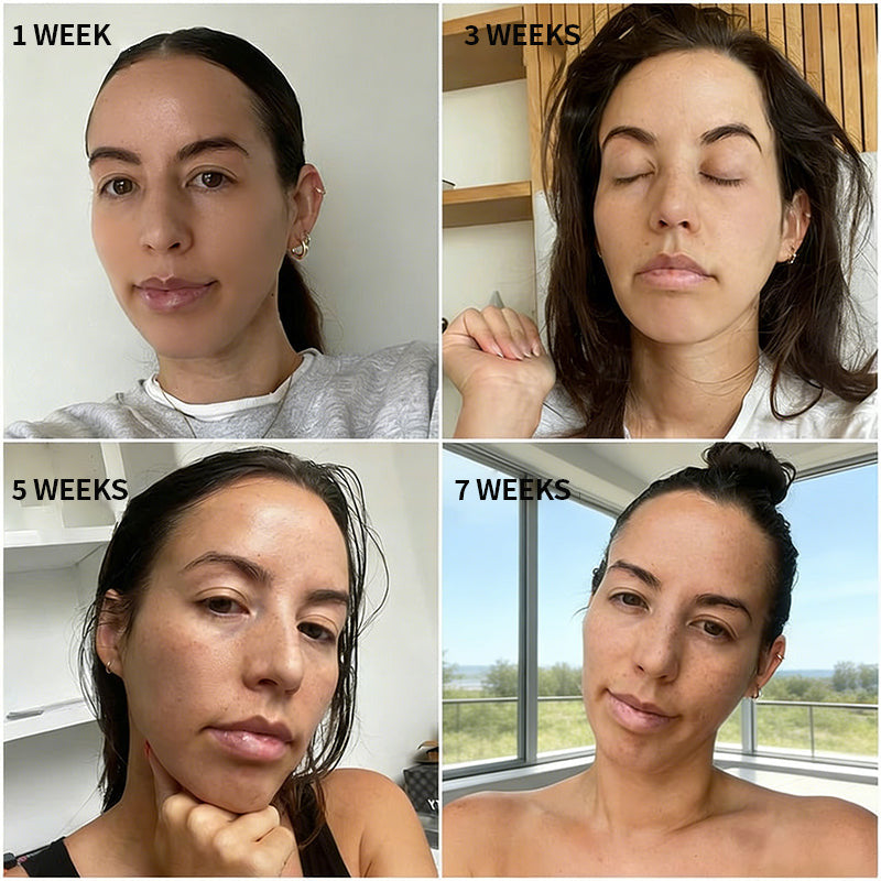 ☘️Purelora® Stem Cell Extract EGF and Copper Peptide Revitalizing Essence Cream (deeply activates the skin's internal regeneration, making the skin firmer and smoother)