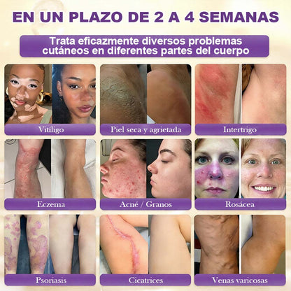 Fabricada y enviada desde EE. UU. 🍁 Crema reparadora de la piel Purelora® con biotina (fórmula 10 en 1) — Último día de oferta: 75 % de descuento.