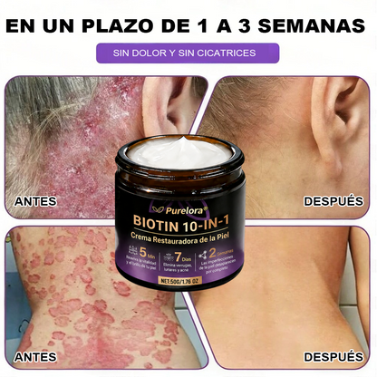 Fabricada y enviada desde EE. UU. 🍁 Crema reparadora de la piel Purelora® con biotina (fórmula 10 en 1) — Último día de oferta: 75 % de descuento.