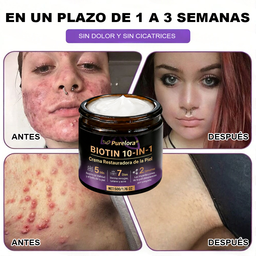 Fabricada y enviada desde EE. UU. 🍁 Crema reparadora de la piel Purelora® con biotina (fórmula 10 en 1) — Último día de oferta: 75 % de descuento.