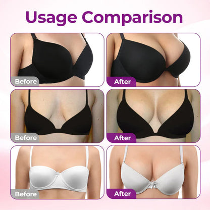 🏆Purelora® ✨BREAST VOLUME BOOST & FIRM Advanced Nano Microneedle Patch🎀