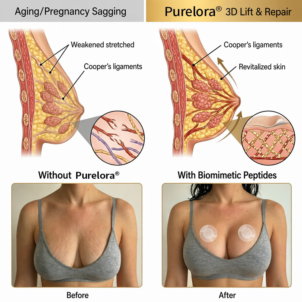🏆Purelora® ✨BREAST VOLUME BOOST & FIRM Advanced Nano Microneedle Patch🎀