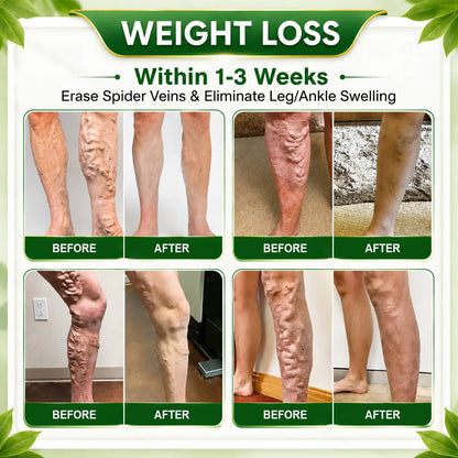 🇺🇸👩‍⚕️𝐎𝐟𝐟𝐢𝐜𝐢𝐚𝐥 𝐁𝐫𝐚𝐧𝐝 𝐒𝐭𝐨𝐫𝐞 |🌿𝑷𝒖𝒓𝒆𝒍𝒐𝒓𝒂® 𝑩𝒆𝒓𝒃𝒆𝒓𝒊𝒏𝒆 𝑴𝒐𝒓𝒊𝒏𝒈𝒂- 𝑩𝒆𝒆 𝑽𝒆𝒏𝒐𝒎 Metabolic Wellness Foot Soak Beads