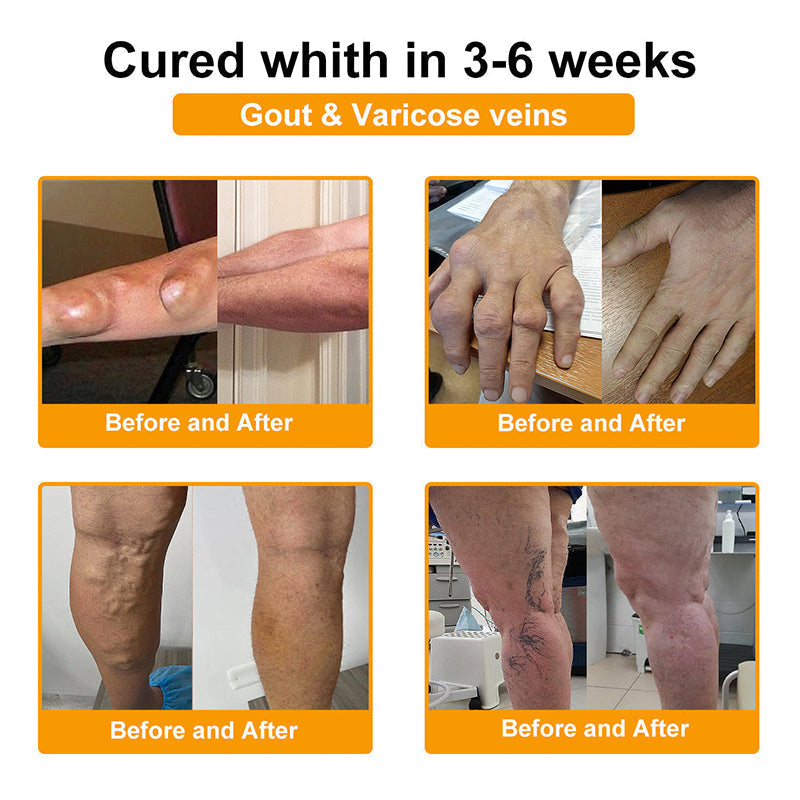 𝗙𝗗𝗔 𝗖𝗲𝗿𝘁𝗶𝗳𝗶𝗲𝗱 · 𝗢𝗳𝗳𝗶𝗰𝗶𝗮𝗹 𝗦𝘁𝗼𝗿𝗲 | Purelora®🔥 BEE VENOM LITHOSPERMUM Pain-Relief Bone Healing Cream 👑👑(Specially for older adults)