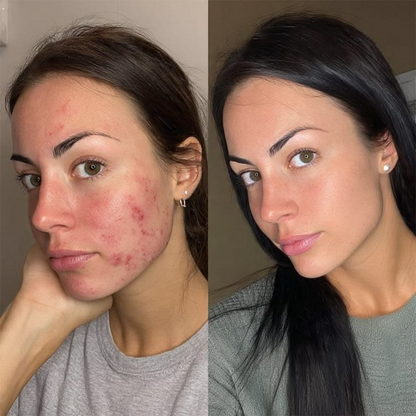 💖【Tienda oficial】Base de maquillaje AdaptaShade de PURELORA®: una base de maquillaje que se adapta al tono de la piel y contiene ingredientes para el cuidado de la piel